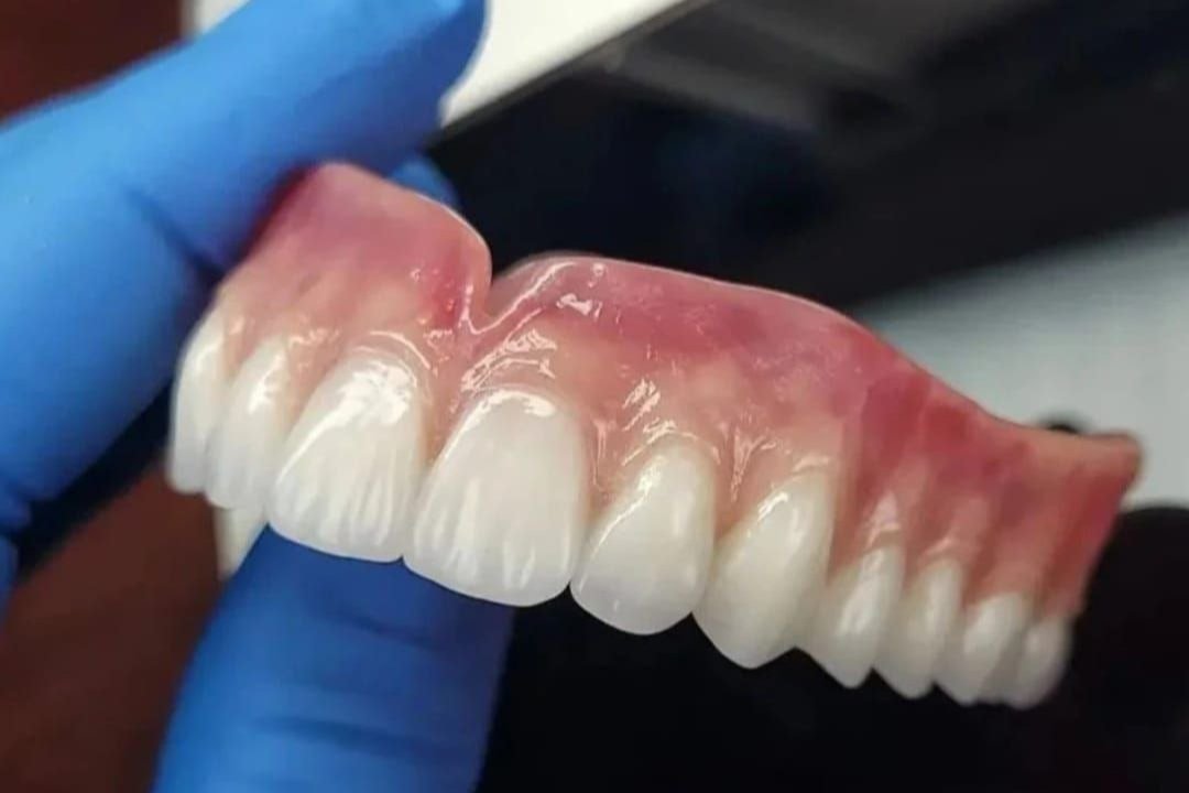 Prótese Dentária Flexível Conforto E Estética Labotarorio Dental Progresso 3681